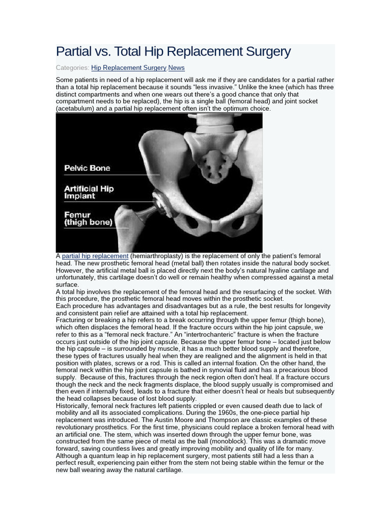 Hip Replacement | PDF | Hip | Medical Specialties