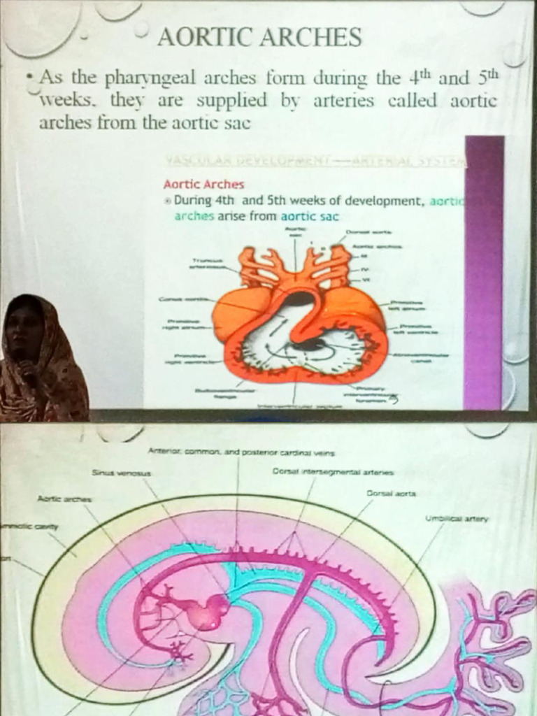 Lec3 Development of Arterial System and Anomalies | PDF