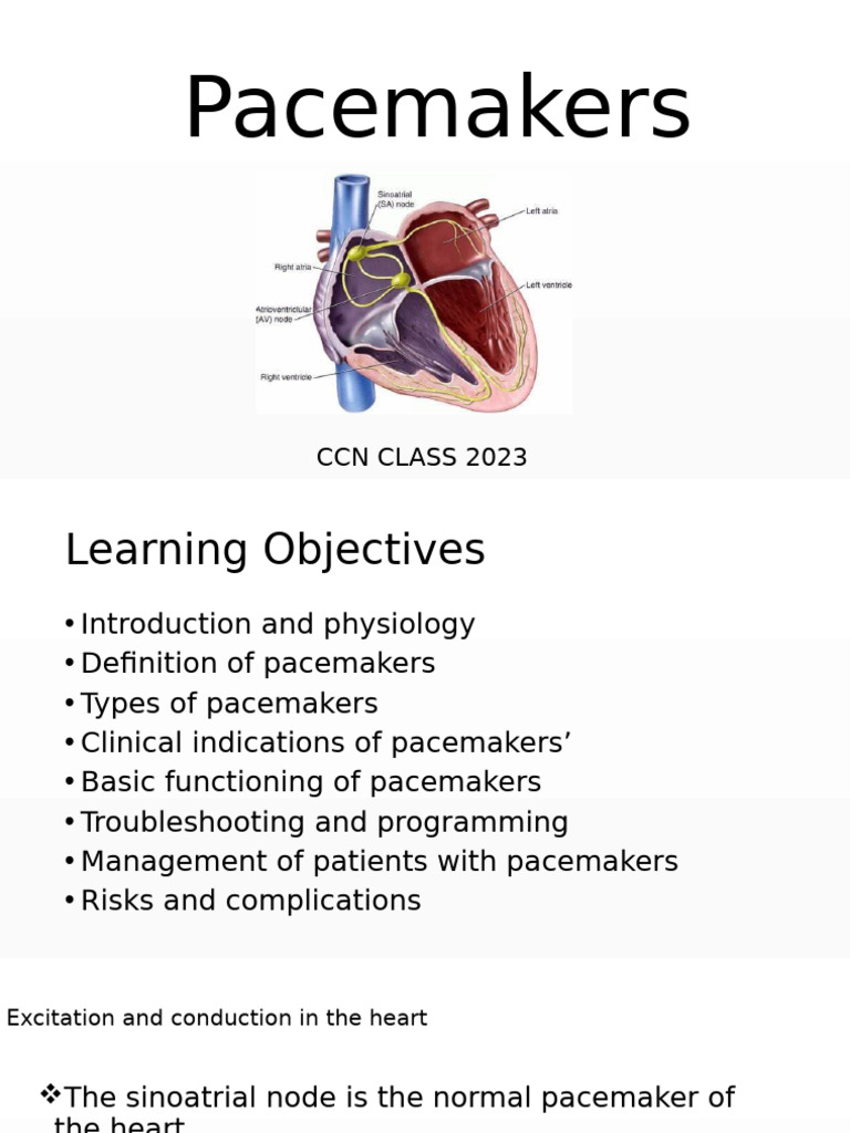 Pacing - CCN Class | PDF | Artificial Cardiac Pacemaker | Heart