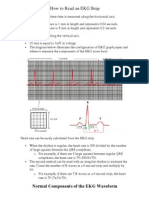 How To Read An EKG Strip