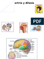 Disartria y Afasia