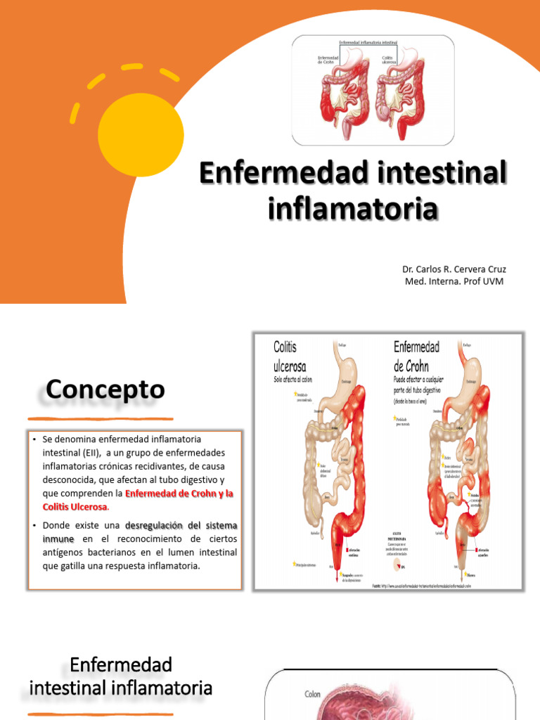 05-Enfermedad Intestinal Inflamatoria | PDF | Enfermedad de Crohn ...
