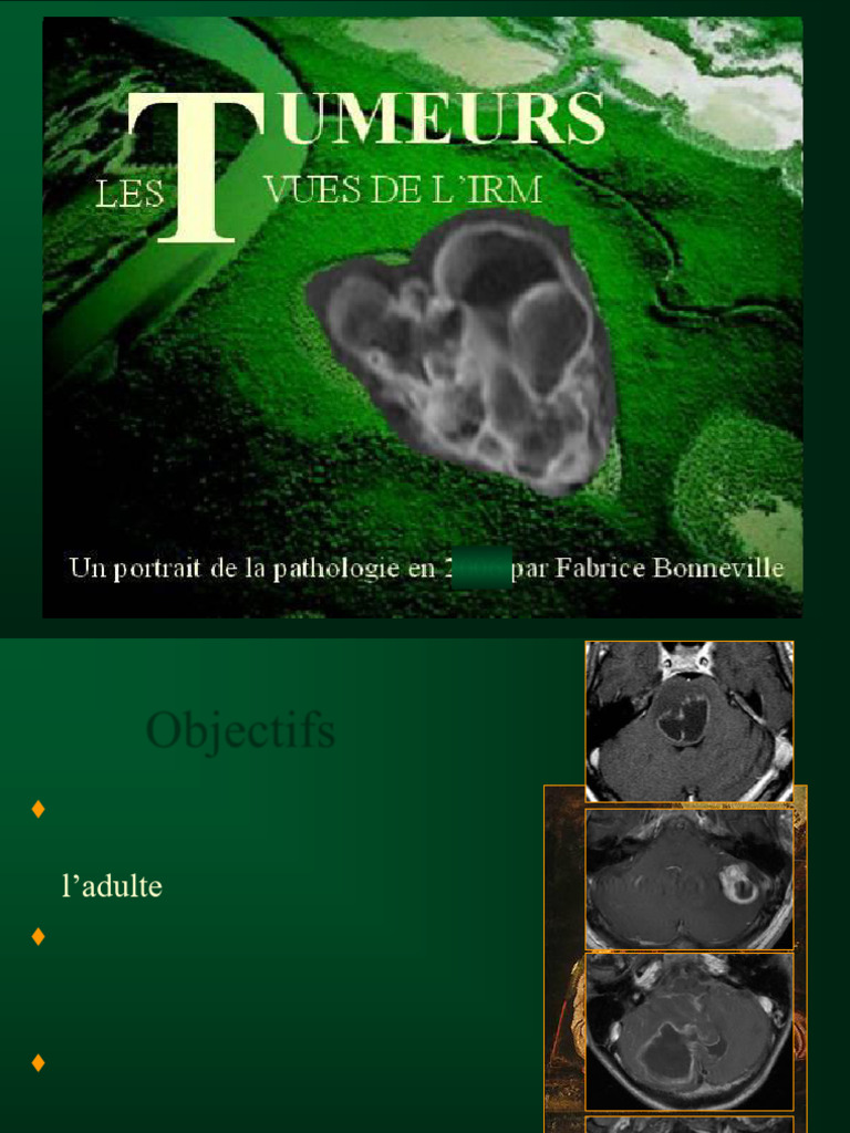 classification-des-tumeurs-c-r-brales-pdf-maladies-et-troubles