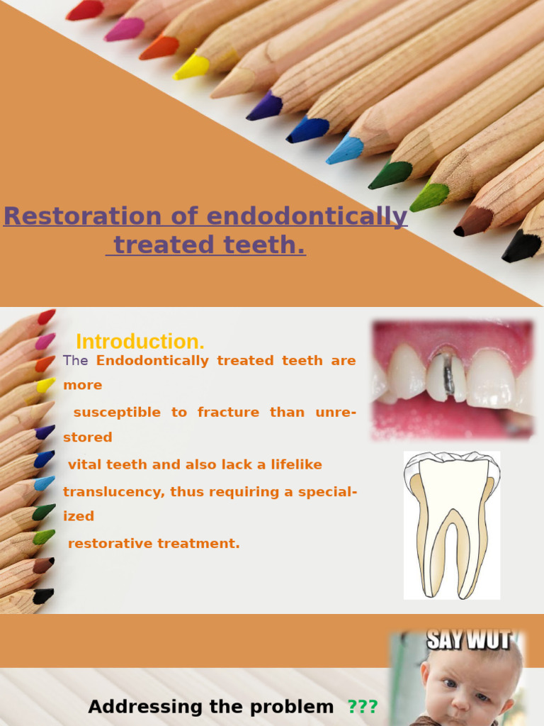 Restoration of Endodontically Treated Teeth | PDF | Dental Composite ...