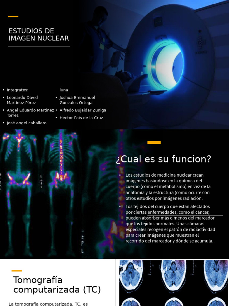 Estudios de Imagen Nuclear | PDF | Ct Scan | Imagen de resonancia magnética