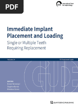 ITI Treatment Guide Volume 14 Dentalbooks Net | PDF | Dental