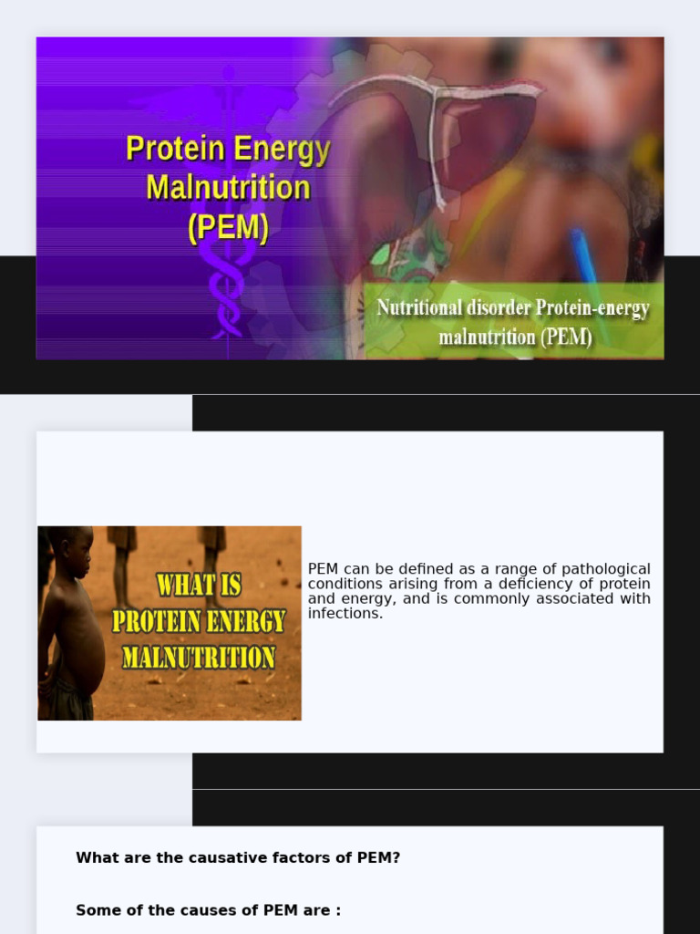 PEM Module 2 | PDF | Malnutrition | Nutrition