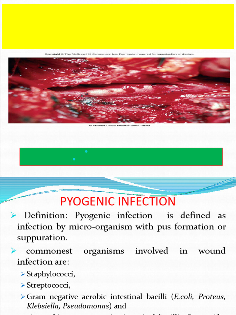 Understanding Pyogenic Wound Infections | PDF | Staphylococcus ...