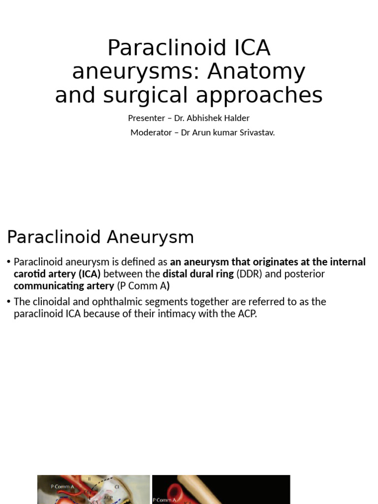 Paraclinoid ICA Aneurysm Overview | PDF | Human Head And Neck | Human ...