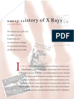 Early History of X-Ray