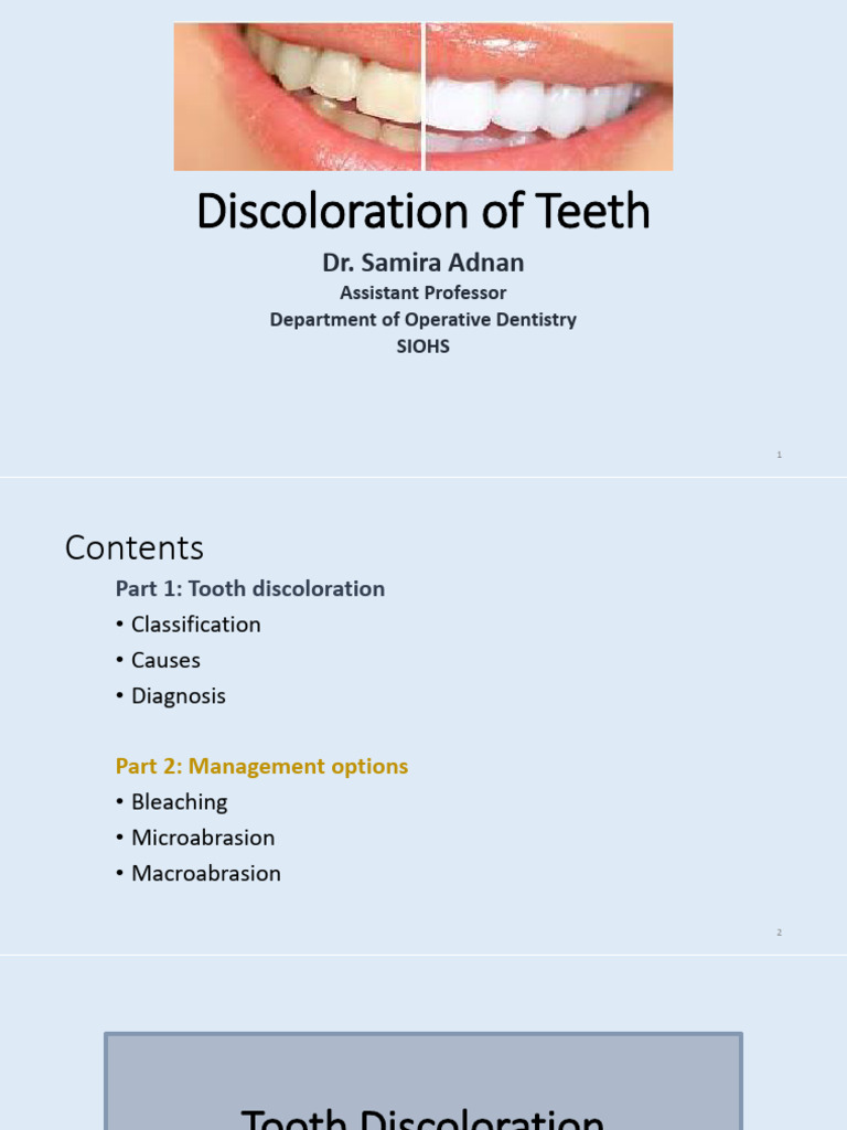 discoloration-of-teeth-part-1-pdf-human-tooth-tooth-enamel