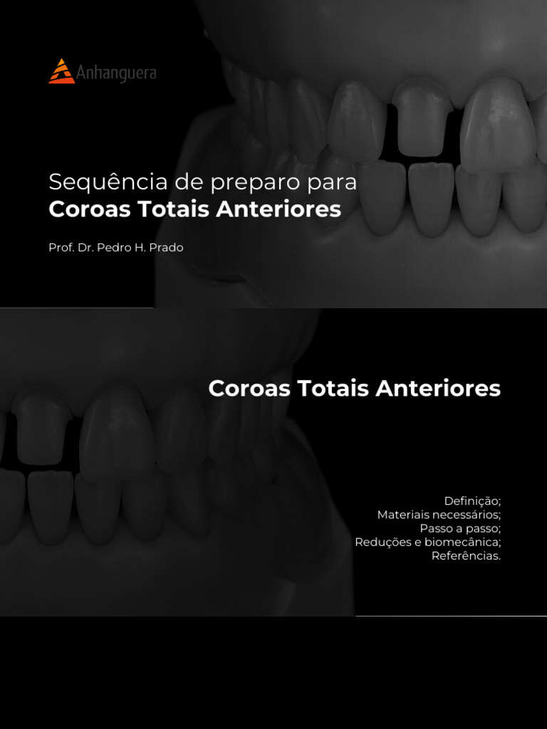 Coroas totais ant e post pdf