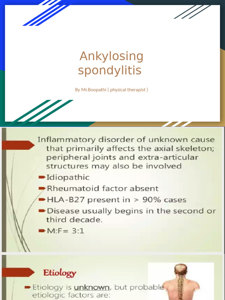 Ankylosing Spondylitis | PDF