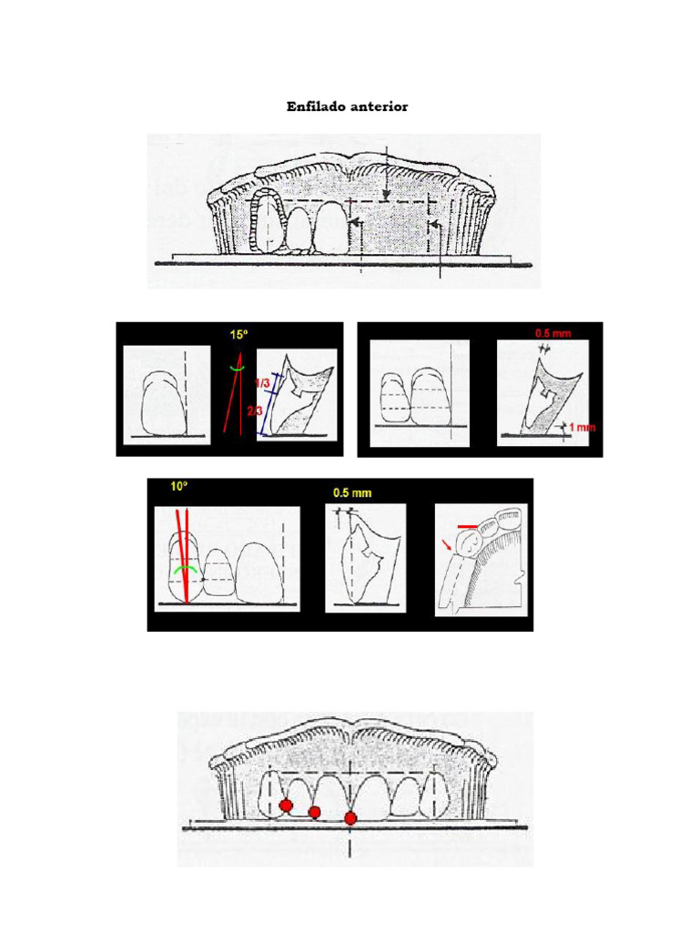 Enfilado Anterior | PDF