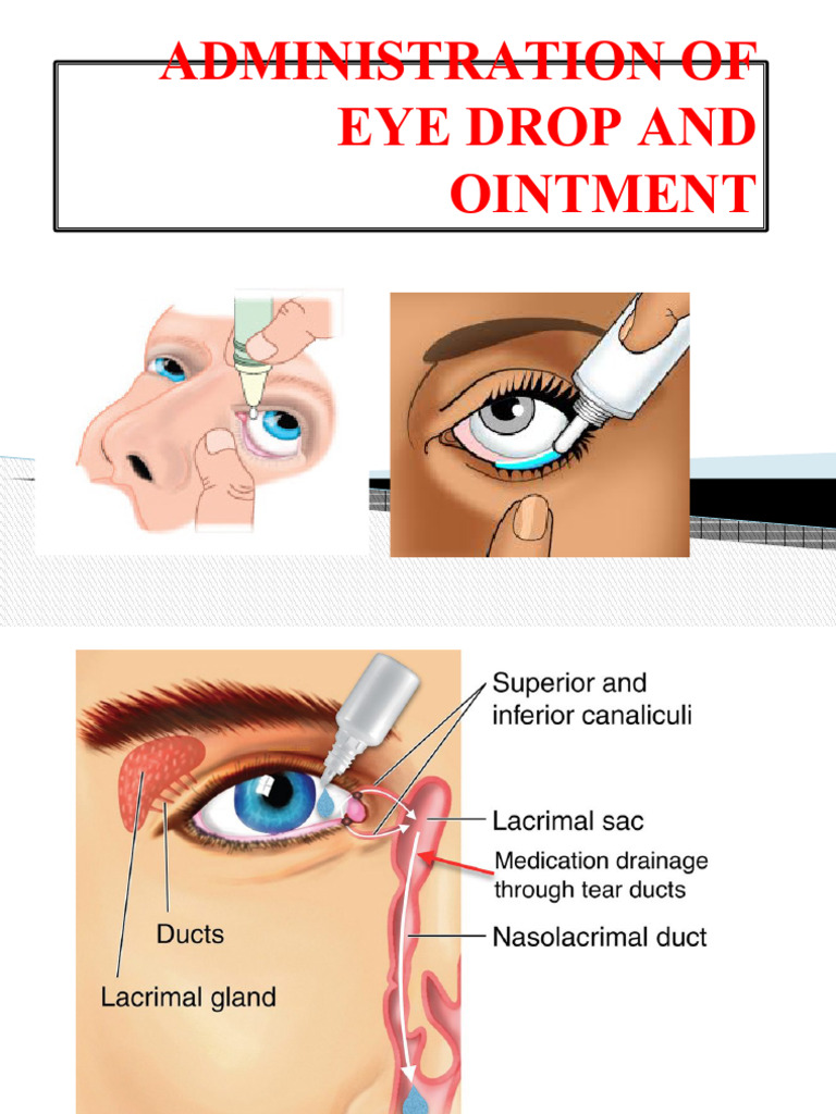 Eye Drop and Ointment Administration Guide | PDF | Clinical Medicine | Eye