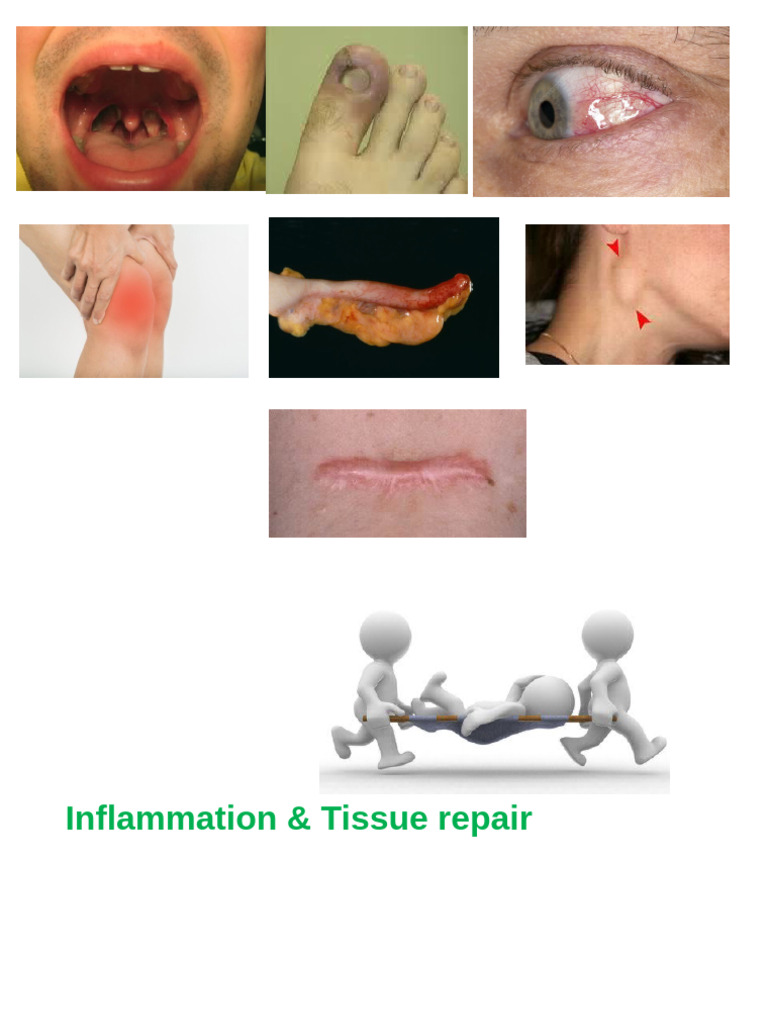 Inflammation Causes & Vascular Response | PDF