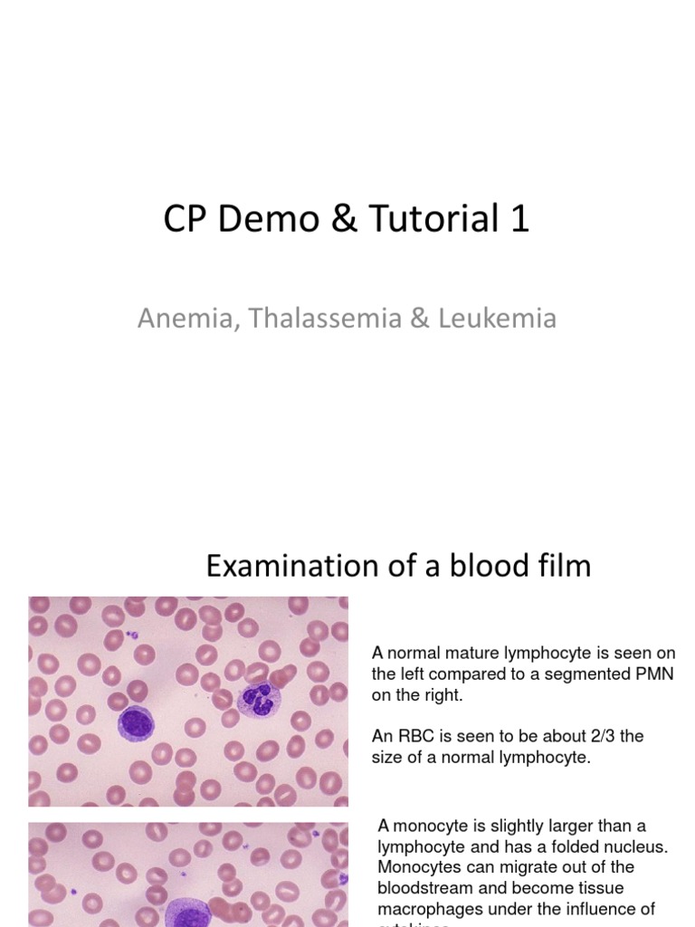 CP Demo & Tutorial 1: Anemia, Thalassemia & Leukemia