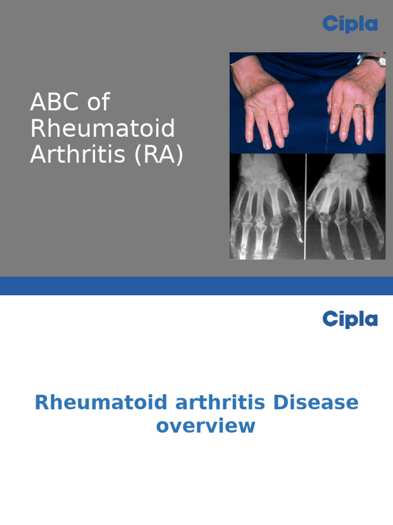 Understanding Rheumatoid Arthritis (RA) | PDF | Rheumatoid Arthritis ...