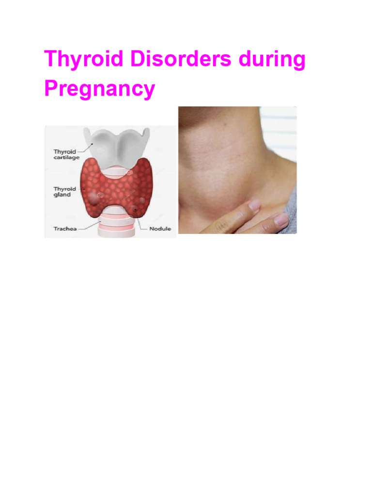 Picture of Thyroid Disorder in Pregnancy | PDF | Thyroid | Hyperthyroidism