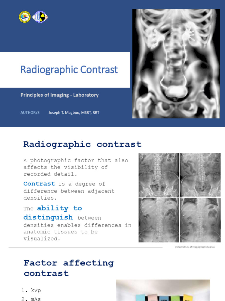 Understanding Radiographic Contrast Factors | PDF | Radiography | X Ray