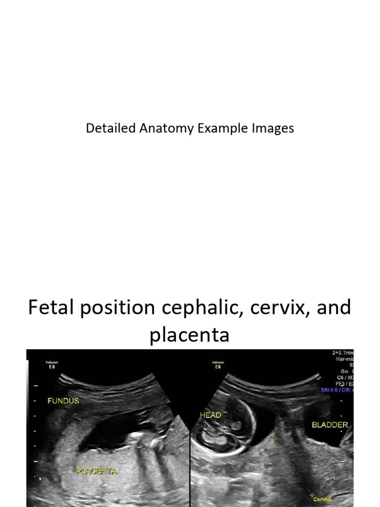 AIUM 2nd Tri Morphology Atlas | PDF