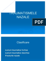 Traumatismele Nazale