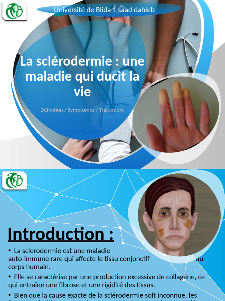 Sclérodermie : Symptômes et Traitements | PDF | Maladies et troubles ...