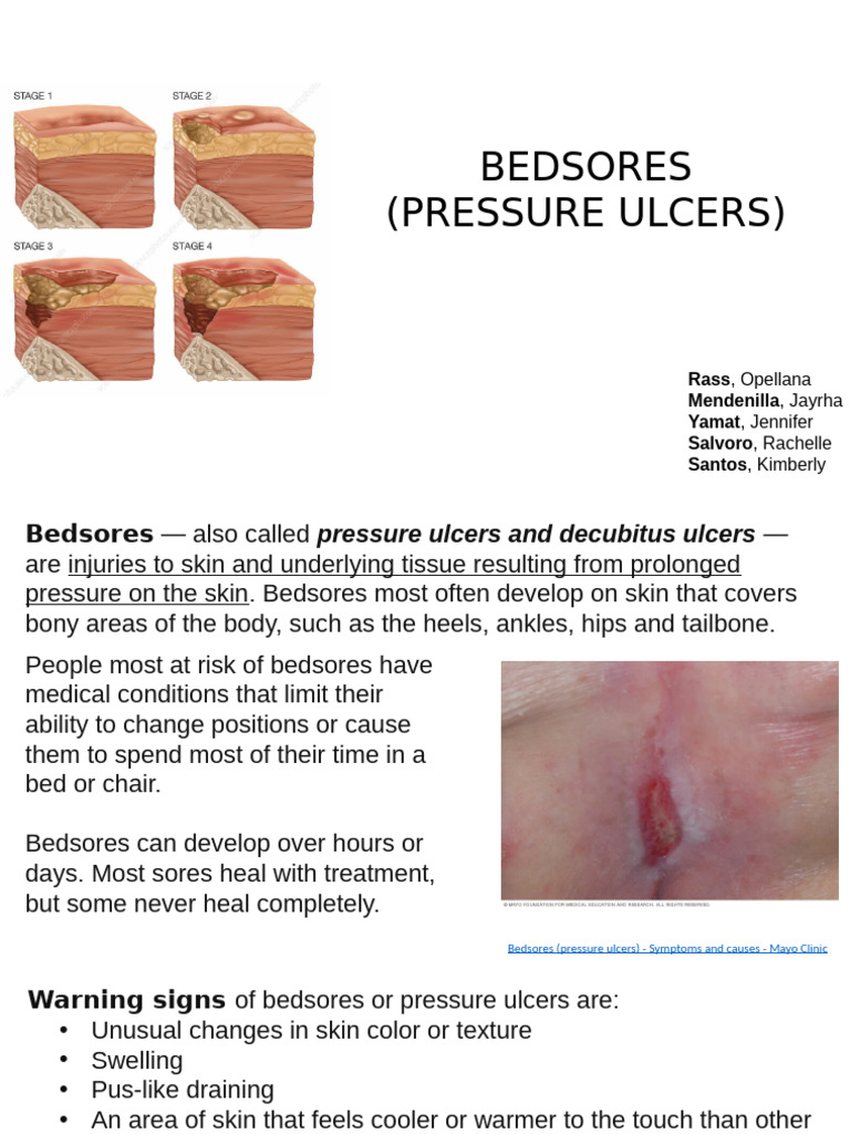 Bedsores Pdf Dermatology Clinical Medicine
