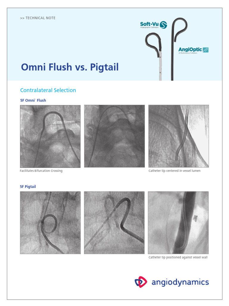 Omni Flush Catheter Overview | PDF | Angiography | Catheter