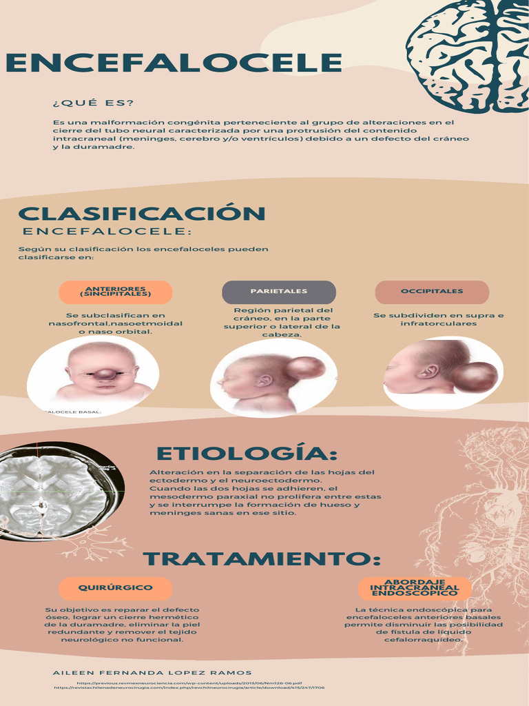 Encefalocele 1 PDF | PDF | Cráneo | Neurociencia