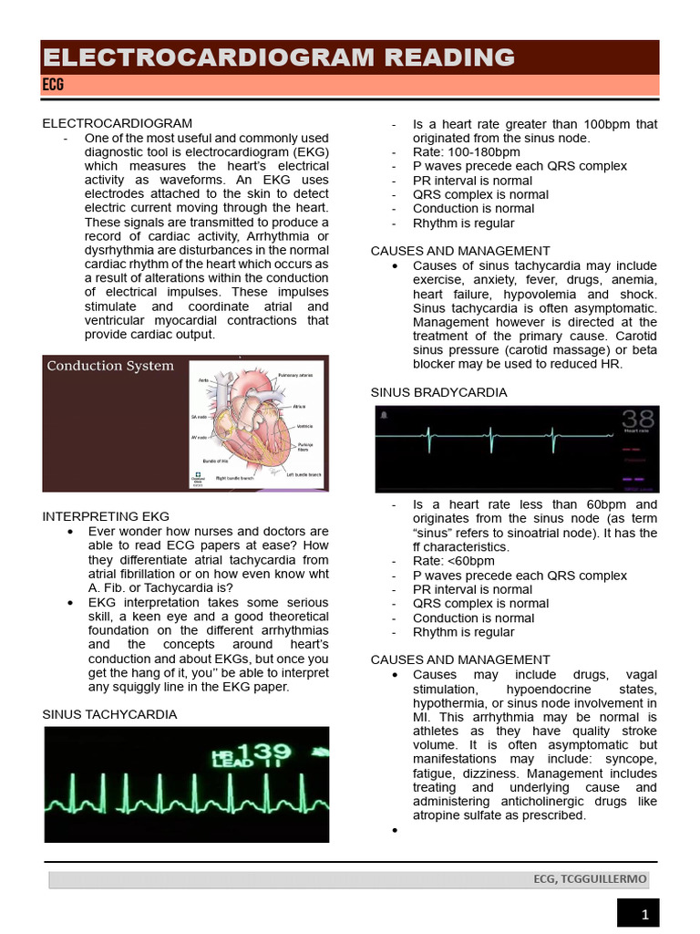 ECG Interpretation and Arrhythmias Guide | PDF | Electrocardiography ...