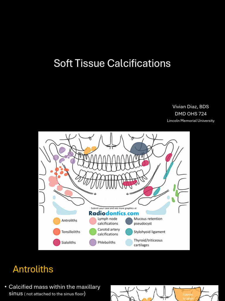 DMD 724 Soft Tissue Calcifications | PDF | Human Anatomy | Human Head ...