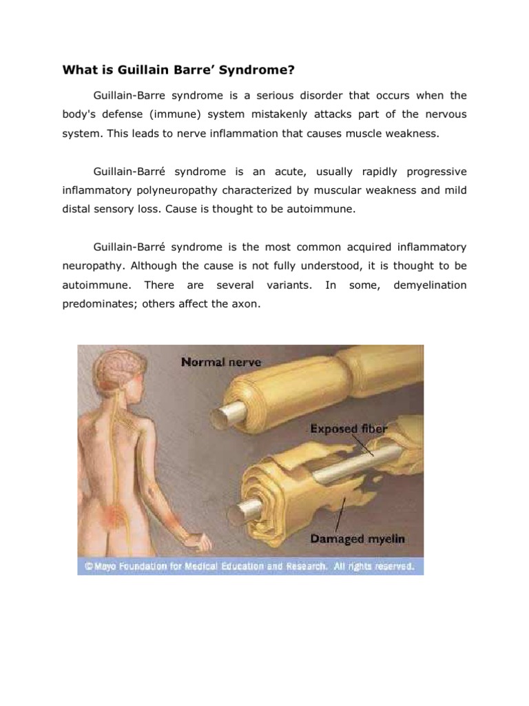 Guillain Barre Syndrome