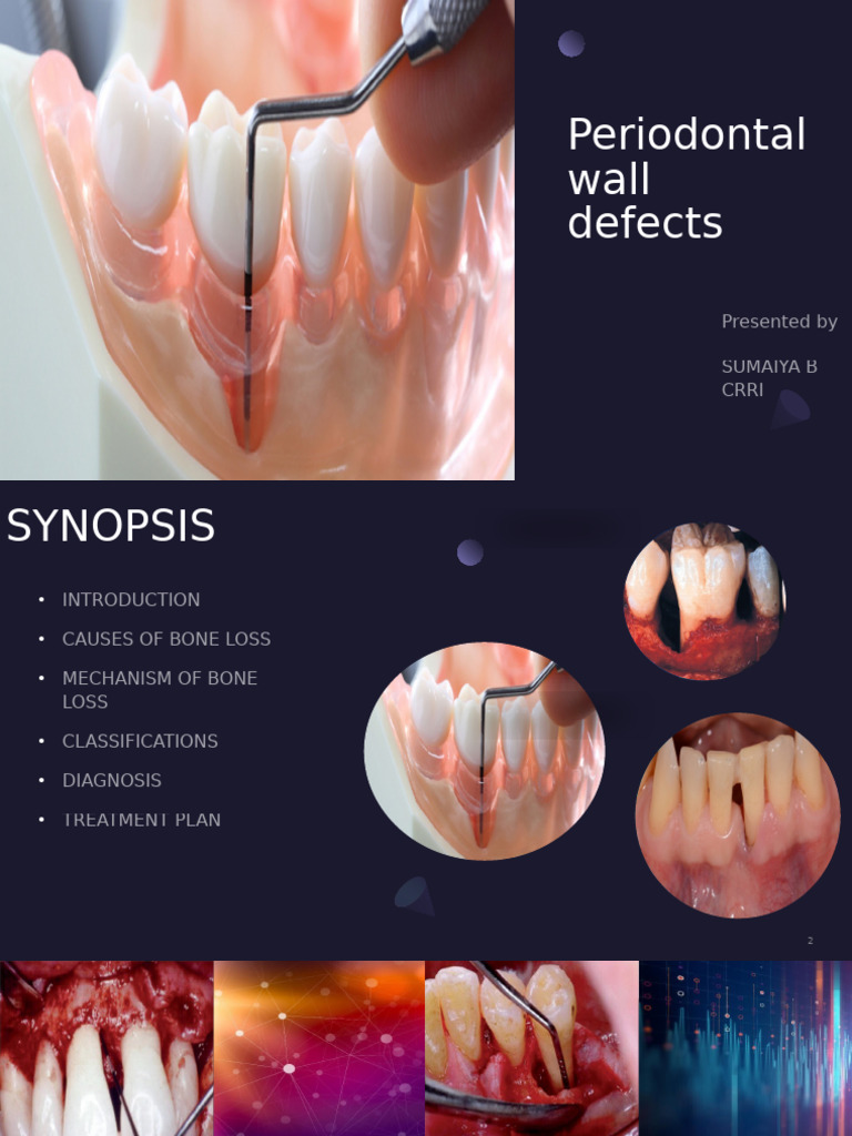 Periodontal Wall Defect Classifications | PDF | Periodontology | Bone