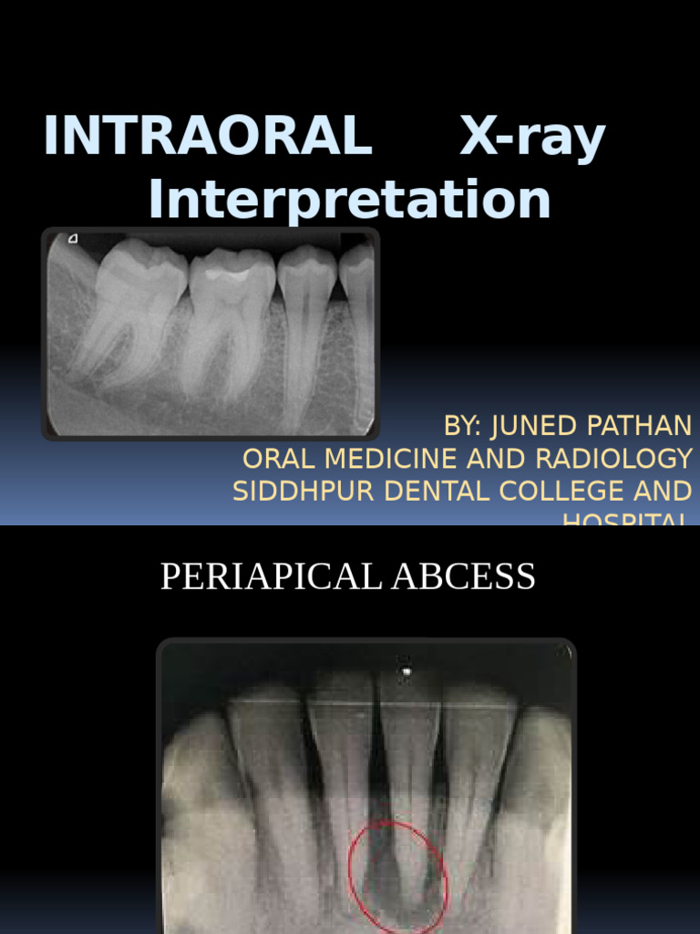 IOPA Radiograph Interpretation Guide | PDF
