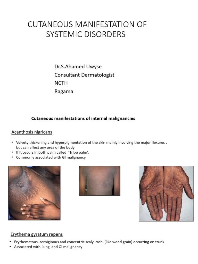 2 - 3.cutaneous Manifestation of | PDF | Inflammatory Bowel Disease ...