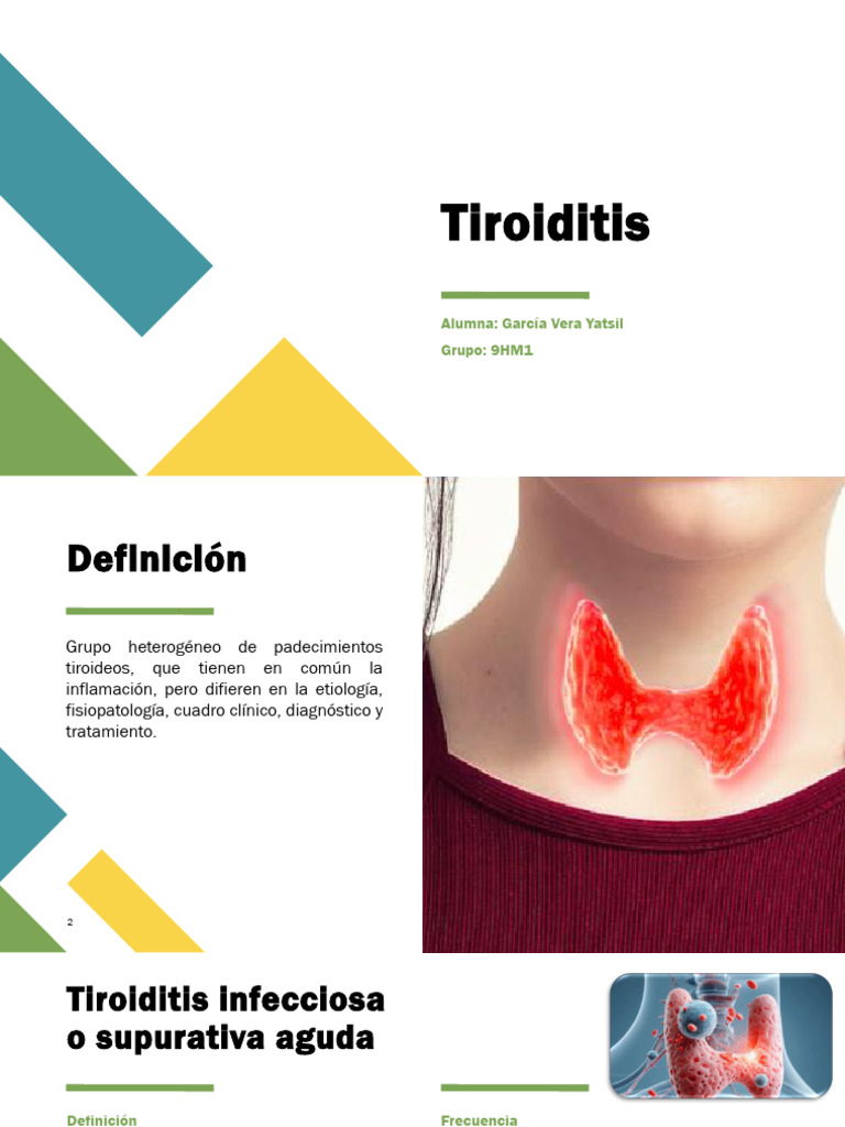 Tiroiditis. Ginecologia y Obstetricia | PDF | Hipertiroidismo | Tiroides