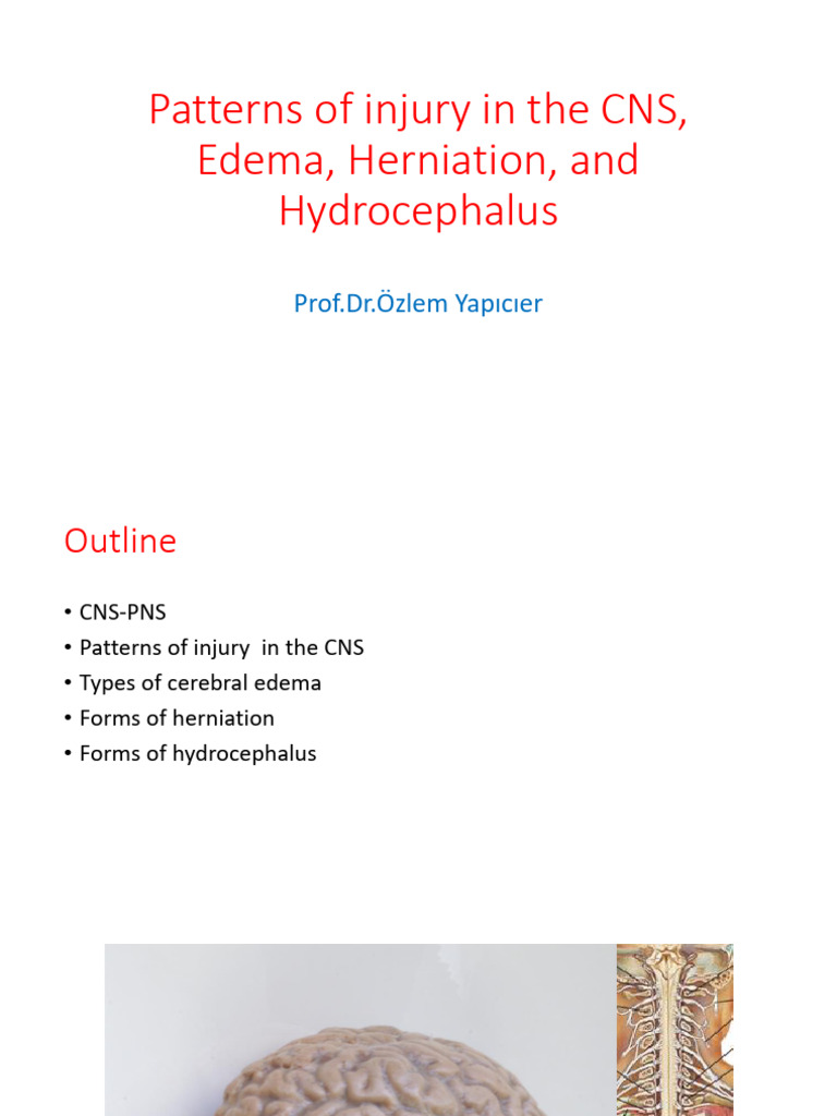 CNS Injury Patterns: Edema & Herniation | PDF | Cerebrospinal Fluid ...