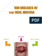 Infeksi Mukosa Mulut