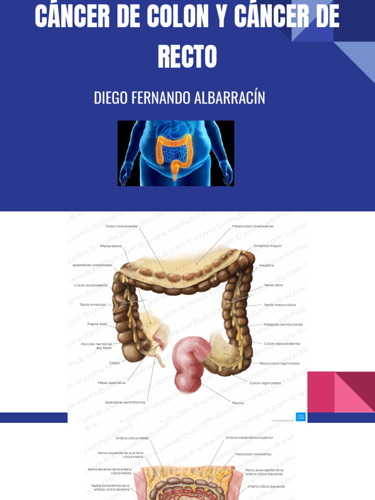 Cáncer de Colon y Ca de Recto | PDF | Cáncer colonrectal | Medicina CLINICA