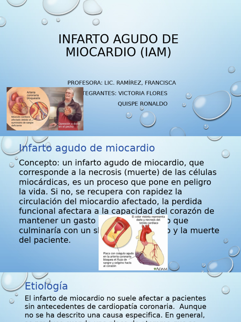 Infarto Agudo de Miocardio: Causas y Tratamiento | PDF | Infarto de ...