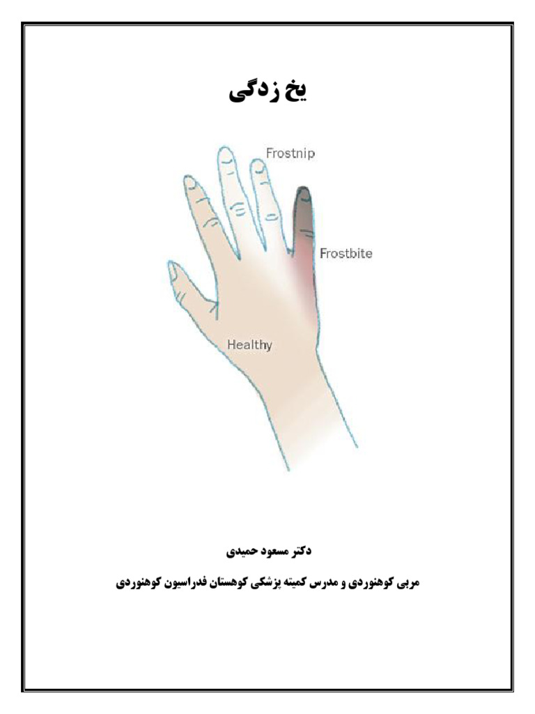 يخ زدگي | PDF