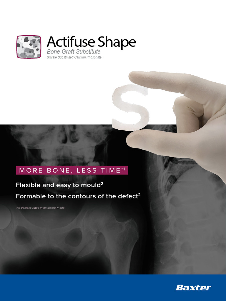 Actifuse Shape: Versatile Bone Graft | PDF | Bone