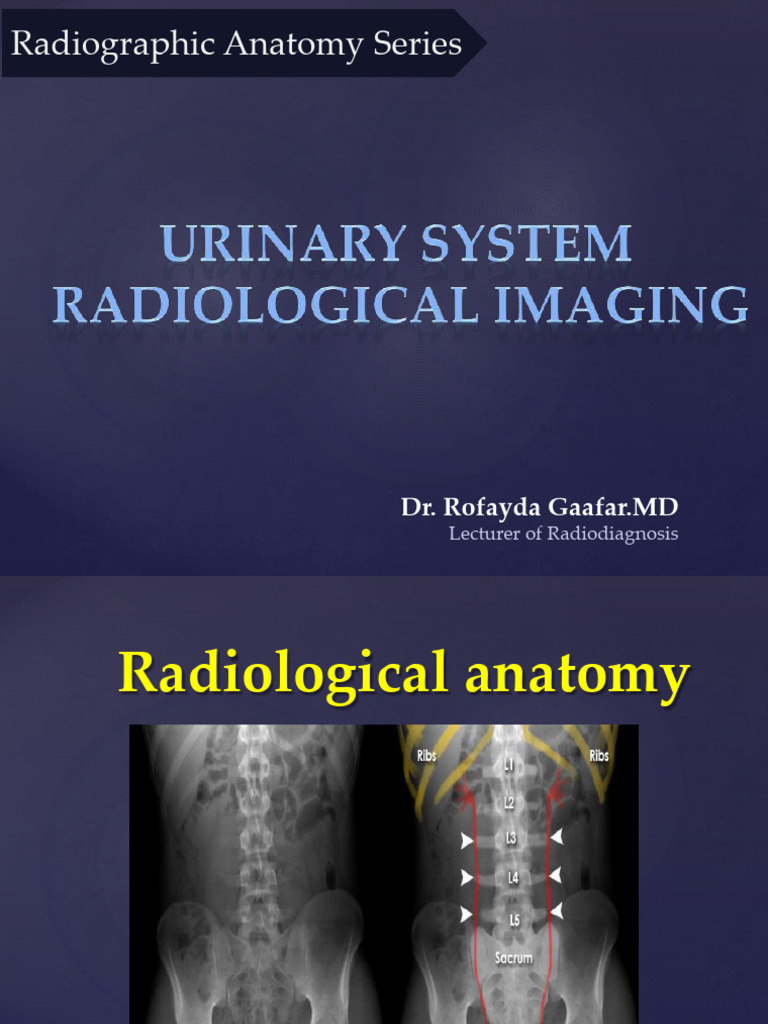 Radiographic Anatomy of Kidneys & Ureters | PDF | Kidney | Vertebra