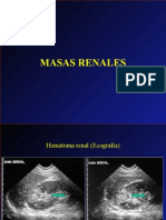 Masas - Renales - Imagen Diagnóstica