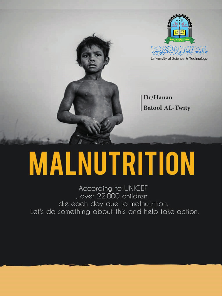 Understanding Malnutrition Causes and Effects | PDF | Dieting ...