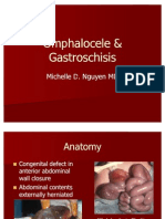 Omphalocele Gastroschisis