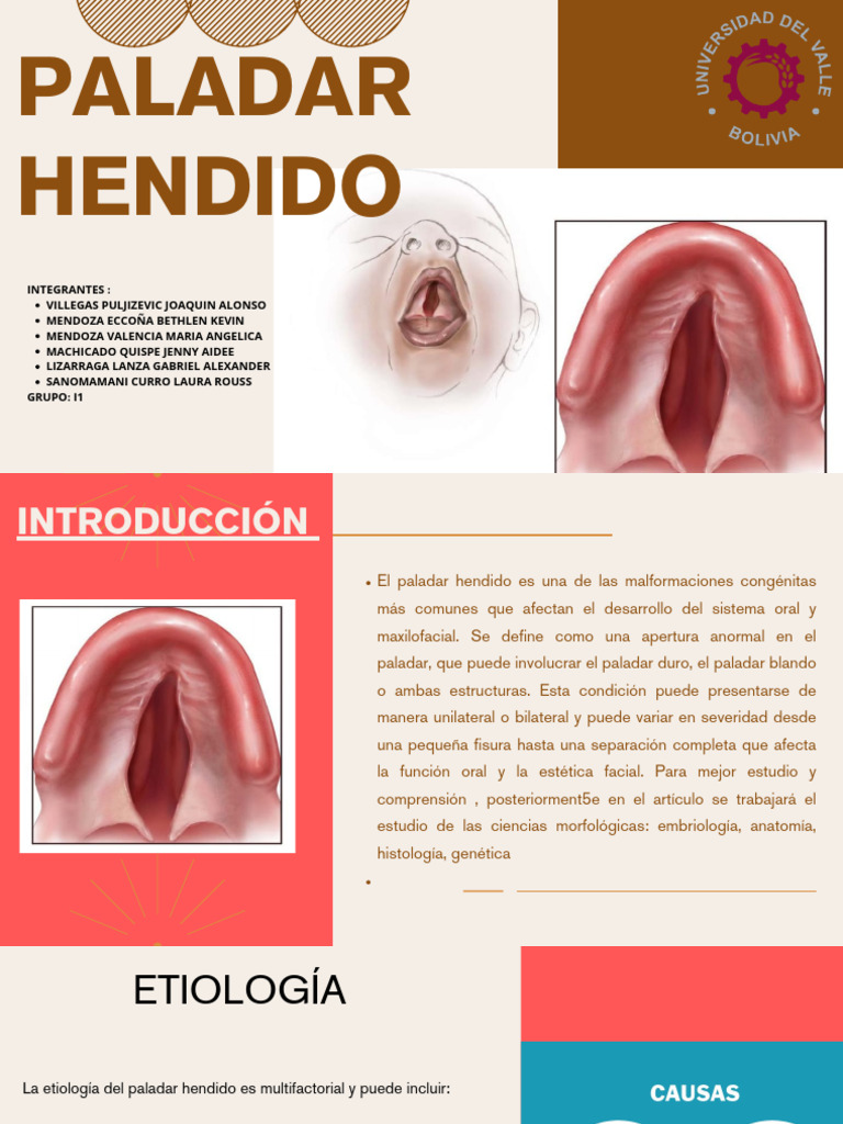 Paladar Hendido: Causas y Tratamiento | PDF | Anatomía
