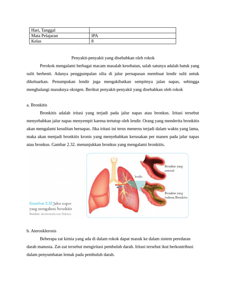 Penyakit Akibat Merokok pada Kelas 8 | PDF
