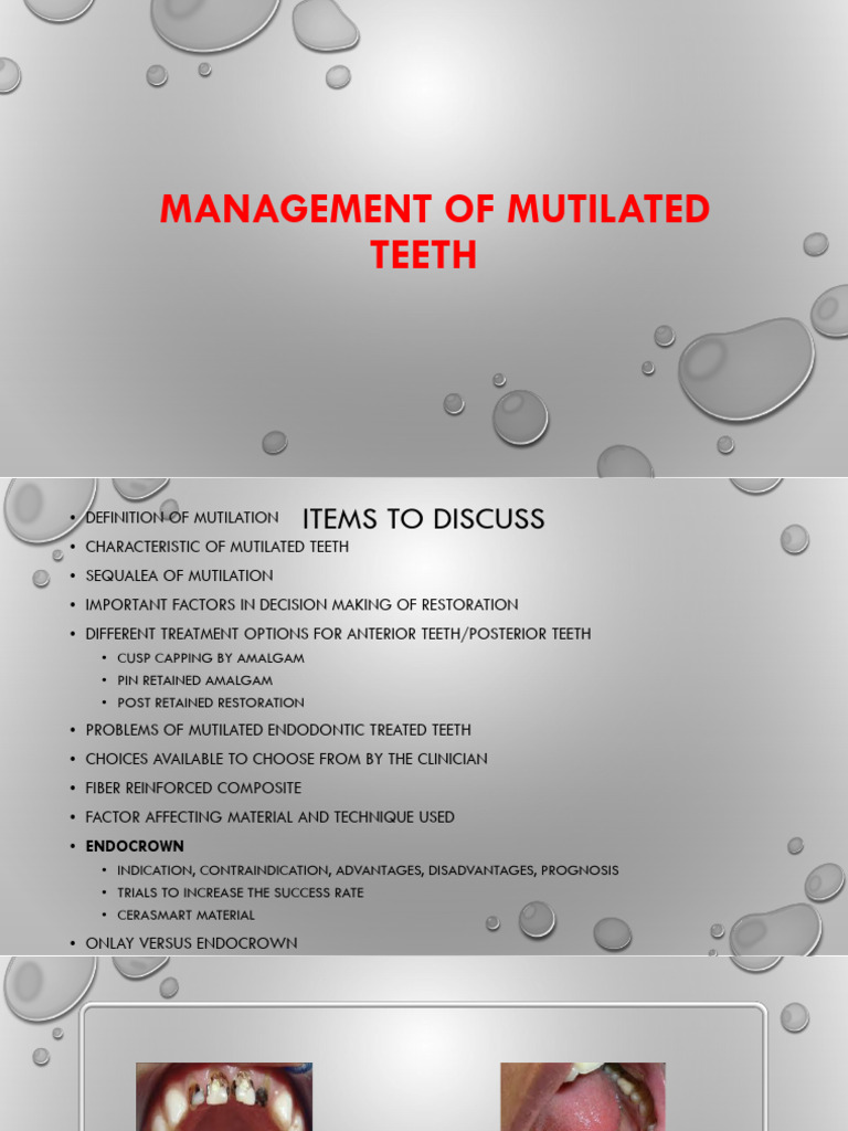 Management of Mutilated Teeth | PDF | Composite Material | Tooth